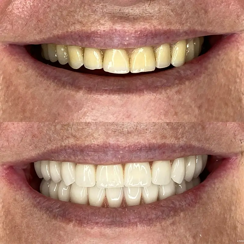 carrossel-antes-depois-4